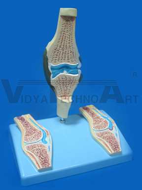 Rheumatoid arthritis model